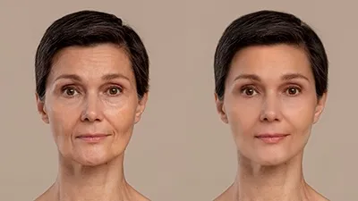 Cosmetic Surgery