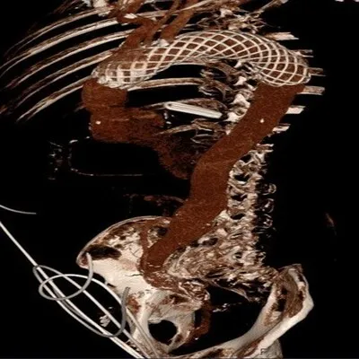  Skeleton holding a snake in its mouth, symbolizing death and rebirth