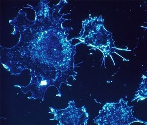 Cancer cells emitting blue fluorescence in darkness, indicating their presence