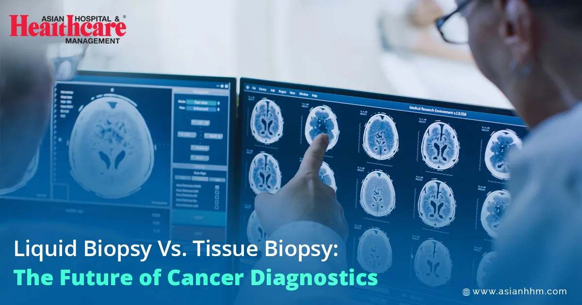 Liquid Biopsy vs. Tissue Biopsy: The Future of Cancer Diagnostics
