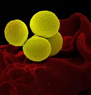Illustration of bacteria or pathogens causing healthcare-associated infections