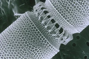 Nanotechnology in Cardiology