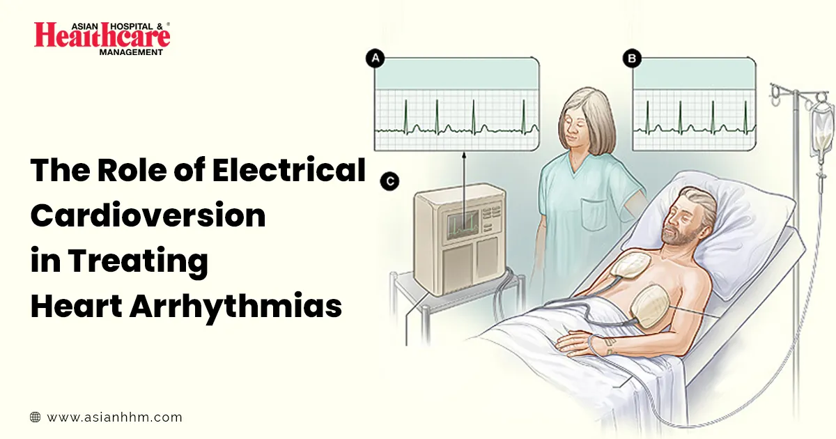 The Role of Electrical Cardioversion in Treating Heart Arrhythmias