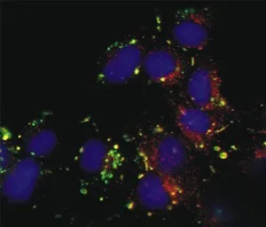 Cells shown in blue and green, representing different types or states