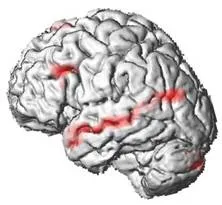verbal hallucinations