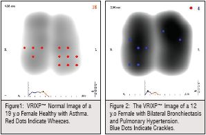 the VRIXP  image of y.o female healthy with asthma red dots indicate wheezes