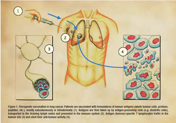 Fig 1: Therapeutic Lung Cancer Vaccines