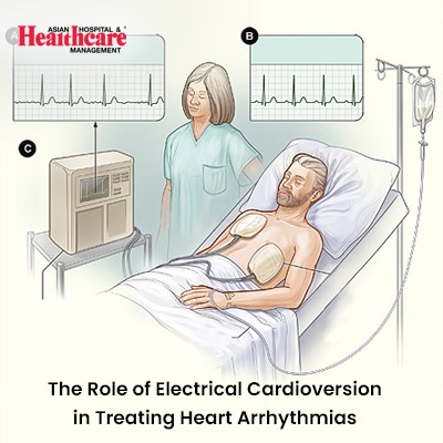 Illustration of electrical cardioversion with a patient on a hospital bed connected to a cardiac monitor.