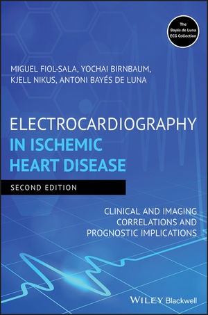 Electrocardiography in Ischemic Heart Disease: Clinical and Imaging Correlations and Prognostic Implications
