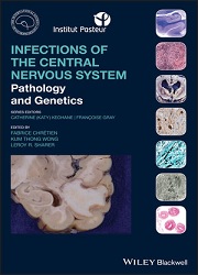 Infections of the Central Nervous System: Pathology and Genetics