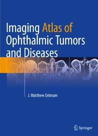 Imaging Atlas of Ophthalmic Tumors and Diseases